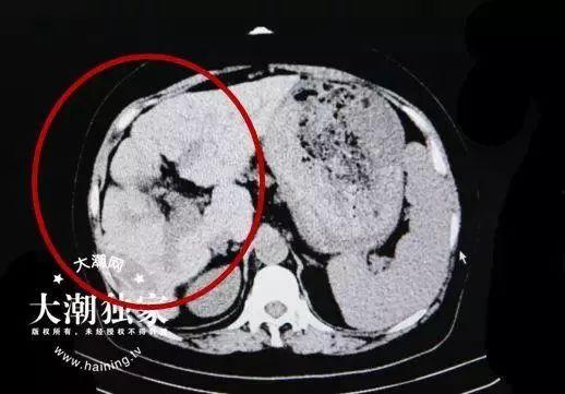 ccgg.ct吃瓜网,揭秘娱乐圈幕后故事,带你领略真实娱乐圈